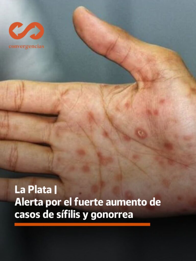 La Plata | Preocupación por el aumento de infecciones de transmisión sexual.-